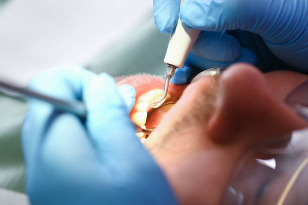 Best Emergency Gum Pain Relief  in Ridgemark, CA
